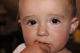 有偿代怀包成功:怀孕后期破水是什么感觉高位破水症状